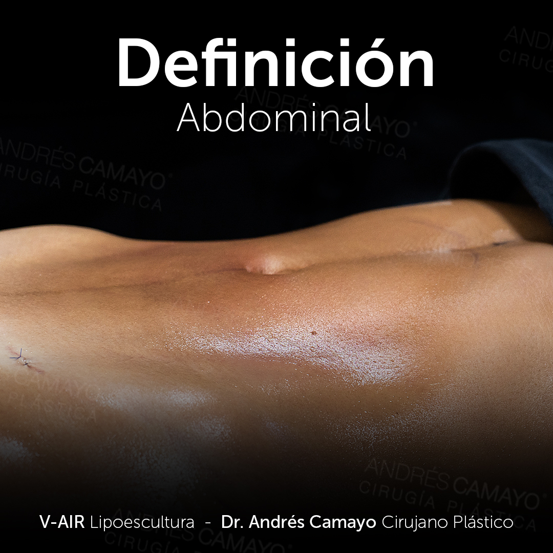 DEFINICIÓN ABDOMINAL